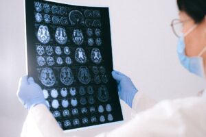 Early-onset cancer rates rose in all three countries, but not in the same way