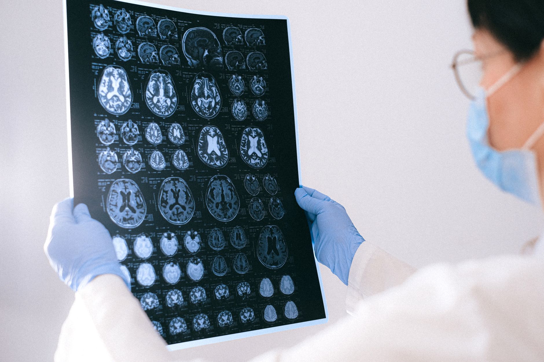 Early-onset cancer rates rose in all three countries, but not in the same way
